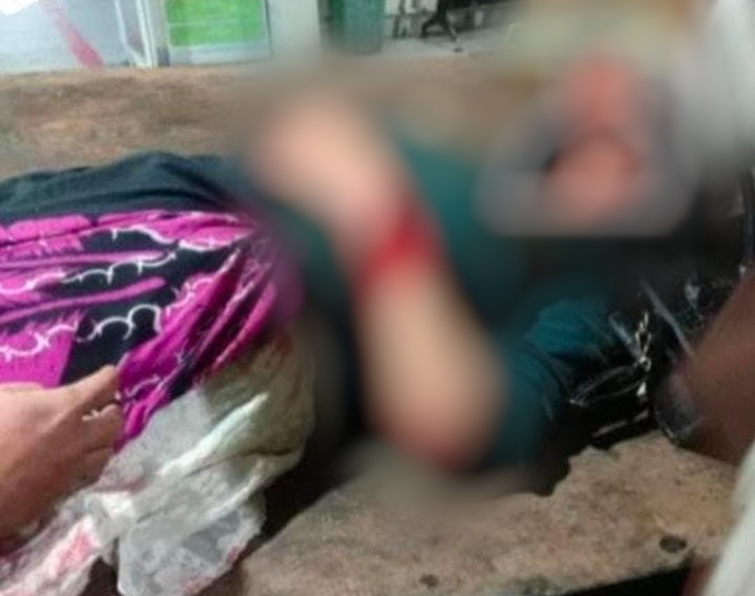 Polisi menyelidiki dugaan pembegalan perempuan 19 tahun di Sungai Kakap, Kubu Raya, yang viral di media sosial. Polisi belum menyimpulkan adanya aksi begal. (Istimewa)